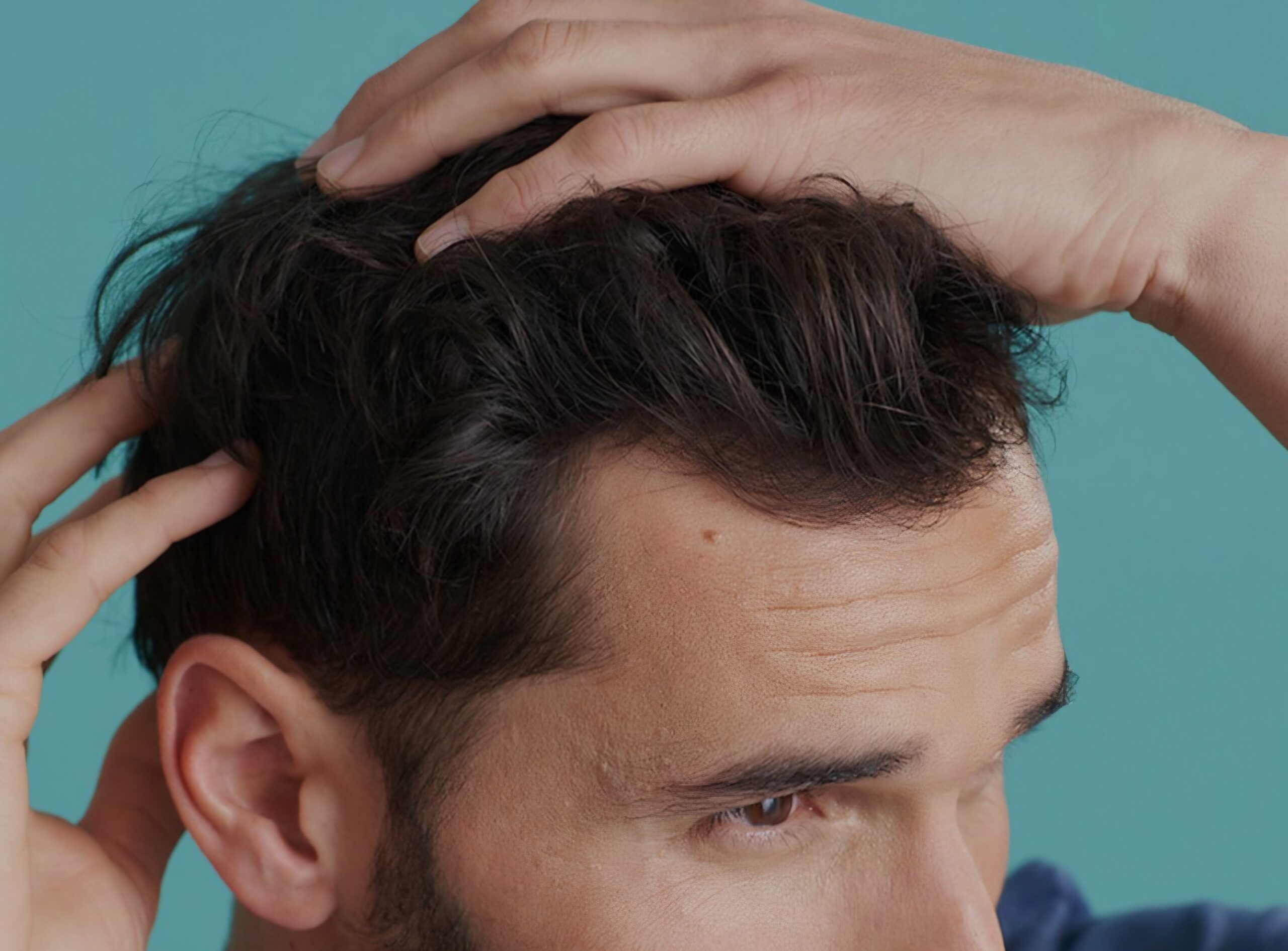 6 precautions against hair loss in men: